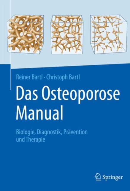 Das Osteoporose Manual : Biologie, Diagnostik, Pravention und Therapie, EPUB eBook