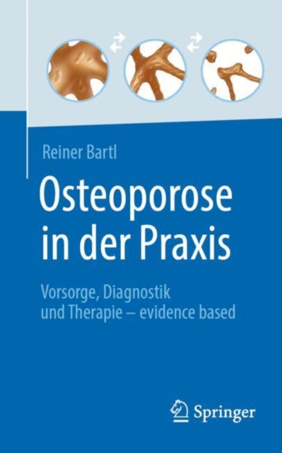 Osteoporose in der Praxis : Vorsorge, Diagnostik und Therapie - evidence based, EPUB eBook