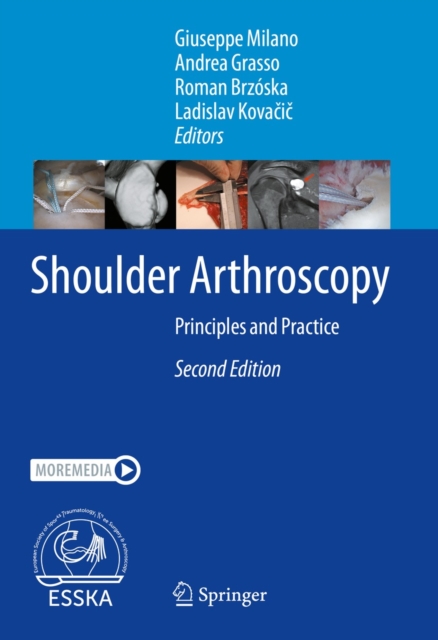 Shoulder Arthroscopy : Principles and Practice, EPUB eBook