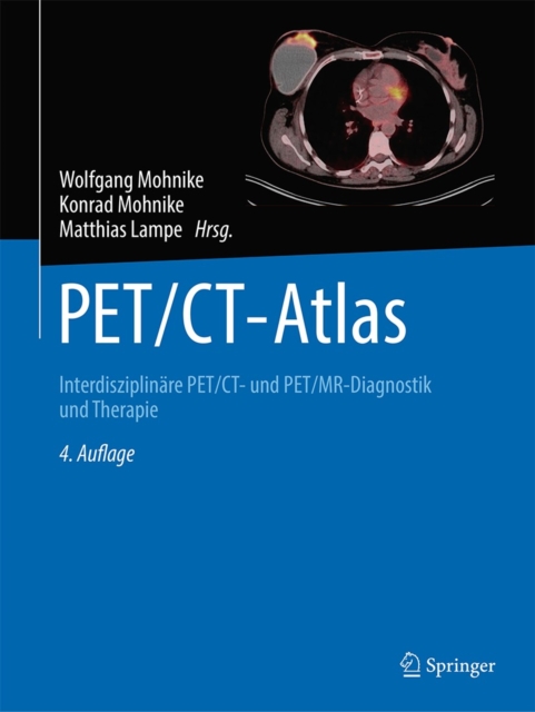 PET/CT-Atlas : Interdisziplinare PET/CT- und PET/MR-Diagnostik und Therapie, EPUB eBook