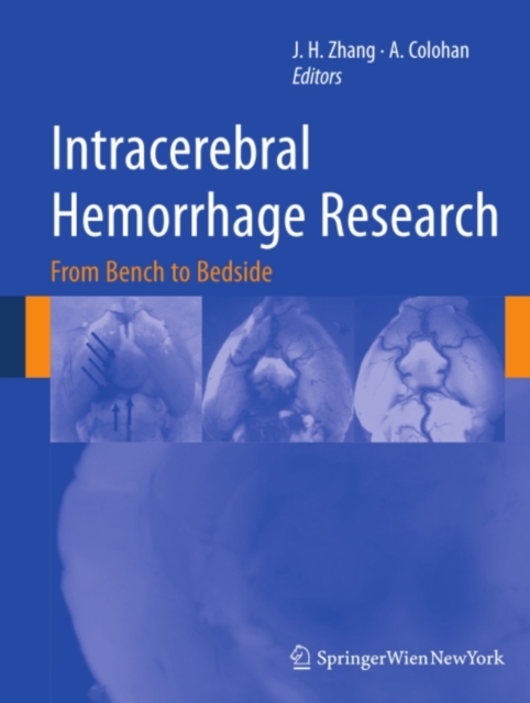 Intracerebral Hemorrhage Research : From Bench to Bedside, PDF eBook