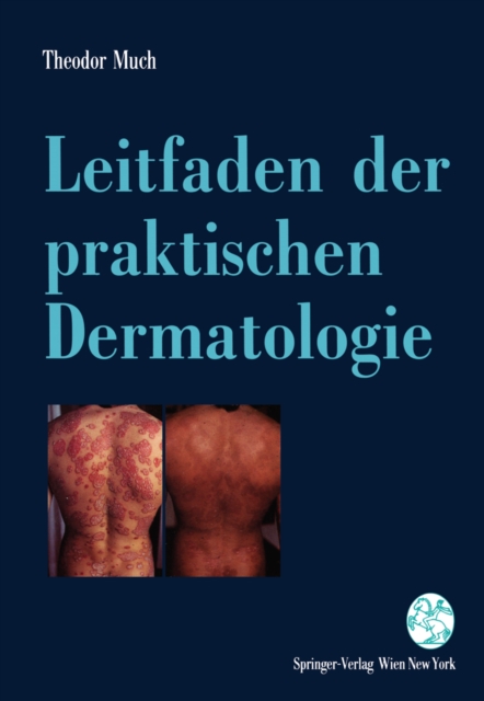 Leitfaden der praktischen Dermatologie : Lokale und systemische Therapie - mit Diagnosehinweisen -, PDF eBook