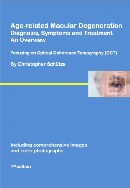 Age-related macular degeneration : Diagnosis, symptoms and treatment, an overview, EPUB eBook