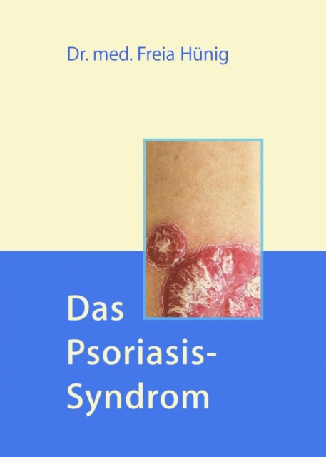 Das Psoriasis-Syndrom, EPUB eBook