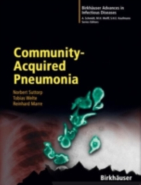 Community-Acquired Pneumonia, PDF eBook