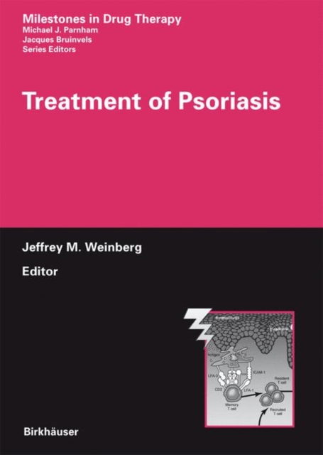 Treatment of Psoriasis, Hardback Book