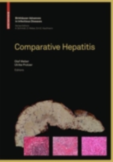 Comparative Hepatitis, PDF eBook