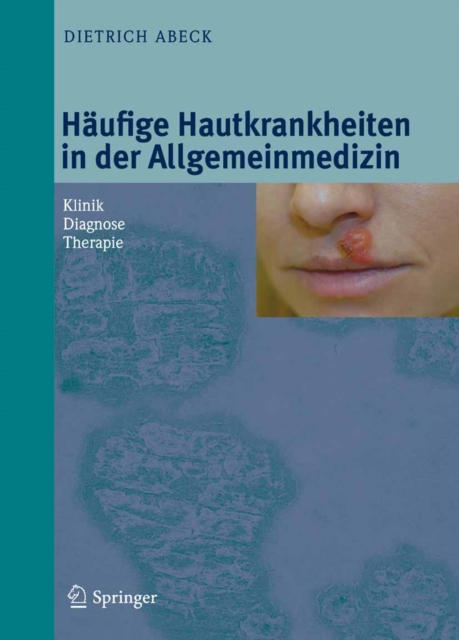 Haufige Hautkrankheiten in der Allgemeinmedizin : Klinik, Diagnose, Therapie, PDF eBook
