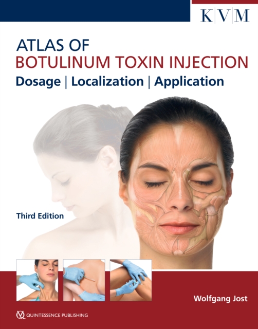 Atlas of Botulinum Toxin Injection : Dosage | Localization | Application, PDF eBook