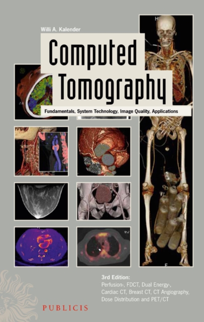 Computed Tomography : Fundamentals, System Technology, Image Quality, Applications, PDF eBook