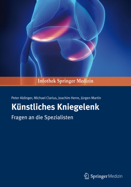 Kunstliches Kniegelenk : Fragen an die Spezialisten, PDF eBook