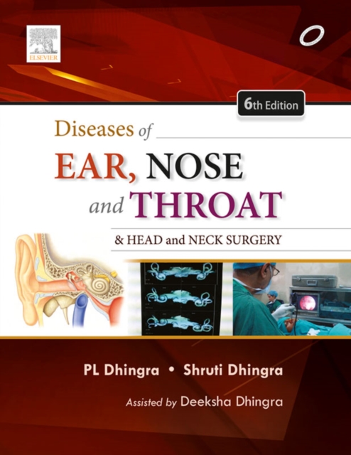 Diseases of Ear, Nose and Throat - E-Book, EPUB eBook