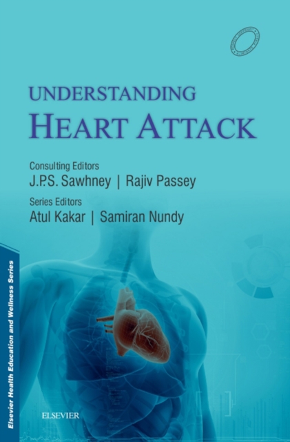 Understanding Heart Attacks - E-Book, EPUB eBook