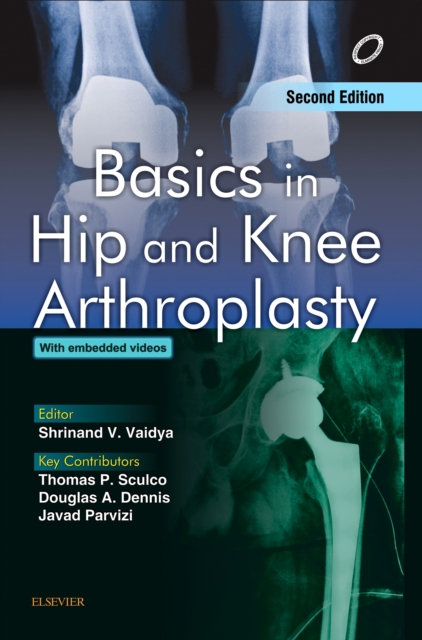 Basics in Hip and Knee Arthroplasty - E-book, EPUB eBook