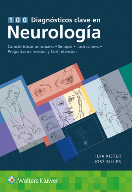 100 diagnosticos clave en neurologia, Paperback / softback Book