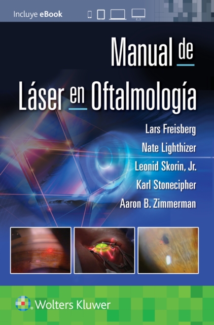Manual de laser en oftalmologia, Paperback / softback Book