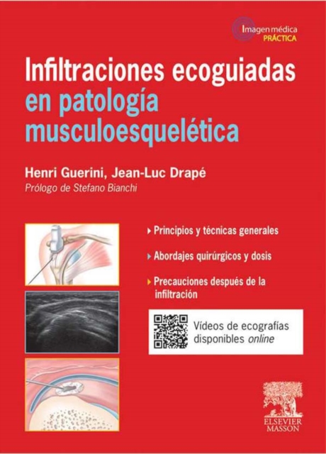 Infiltraciones ecoguiadas en patologia musculoesqueletica, EPUB eBook