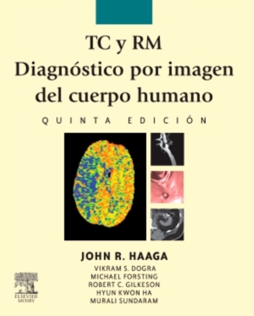 TC y RM. Diagnostico por imagen del cuerpo humano, EPUB eBook