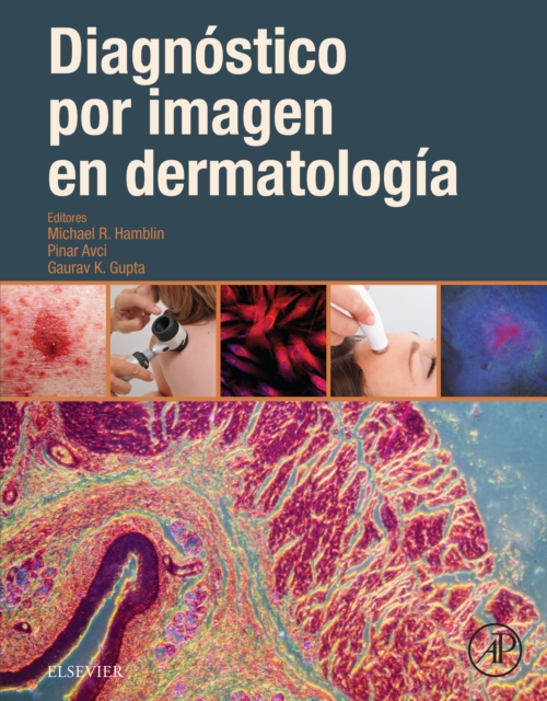 Diagnostico por imagen en dermatologia, EPUB eBook