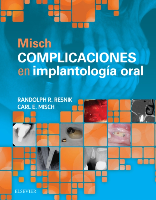 Misch. Complicaciones en implantologia oral, EPUB eBook