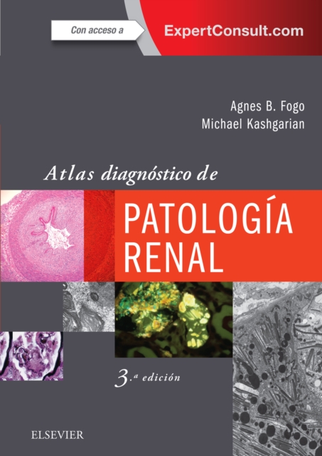 Atlas diagnostico de patologia renal, EPUB eBook