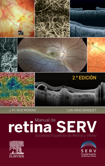 Manual de retina SERV, EPUB eBook