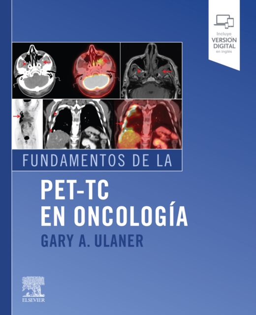 Fundamentos de la PET-TC en oncologia, EPUB eBook