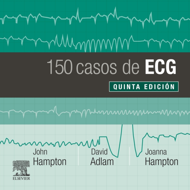 150 casos de ECG, EPUB eBook