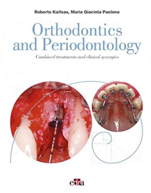 Orthodontics and Periodontology, Hardback Book