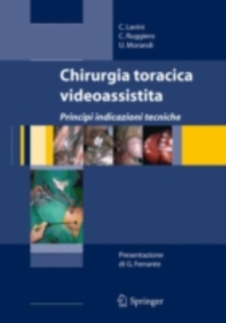 Chirurgia toracica videoassistita, PDF eBook