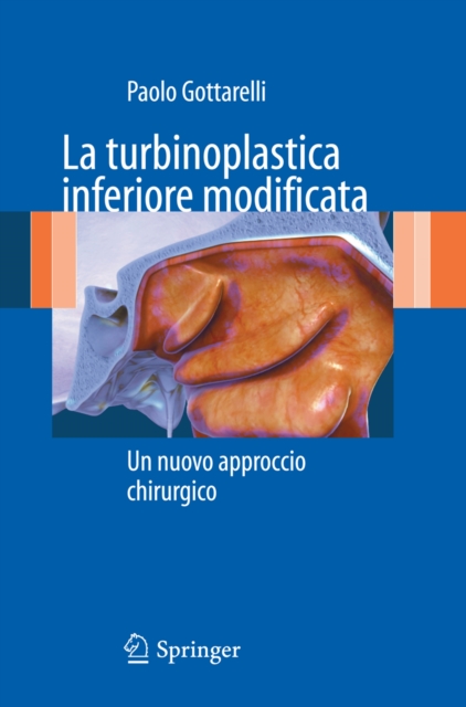 La turbinoplastica inferiore modificata : Un nuovo approccio chirurgico, PDF eBook