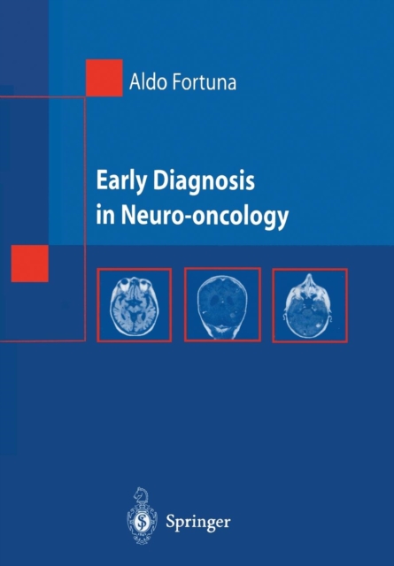 Early Diagnosis in Neuro-oncology, Paperback / softback Book