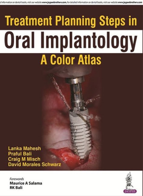 Treatment Planning Steps in Oral Implantology : A Color Atlas, Paperback / softback Book