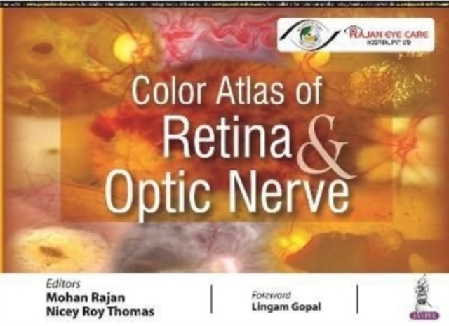 Color Atlas of Retina & Optic Nerve, Hardback Book