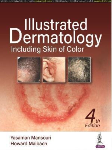 Illustrated Dermatology : Including Skin of Colour, Hardback Book