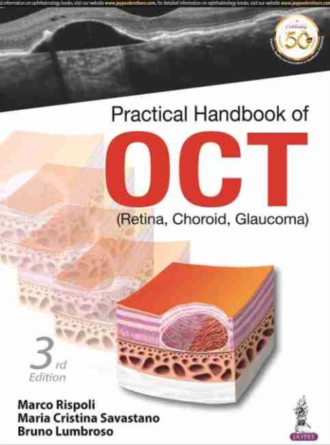 Practical Handbook of OCT : (Retina, Choroid, Glaucoma), Paperback / softback Book