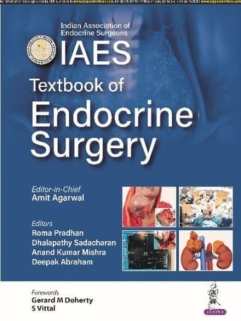 Textbook of Endocrine Surgery, Paperback / softback Book