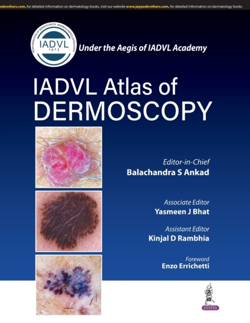 Atlas of Dermoscopy, Paperback / softback Book