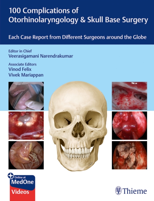 100 Complications of Otorhinolaryngology & Skull Base Surgery : Each Case Report from Different Surgeons around the Globe, Multiple-component retail product, part(s) enclose Book