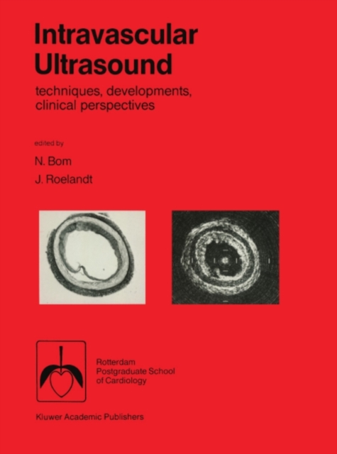 Intravascular ultrasound : Techniques, developments, clinical perspectives, PDF eBook