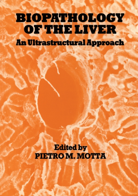 Biopathology of the Liver : An Ultrastructural Approach, PDF eBook