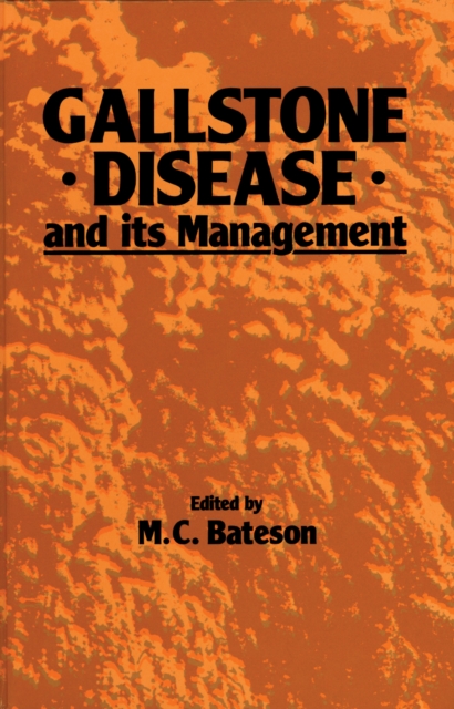 Gallstone Disease and its Management, PDF eBook