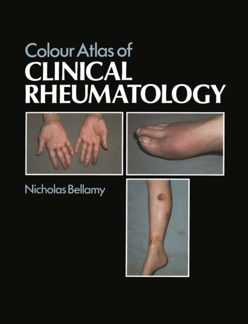 Colour Atlas of Clinical Rheumatology, PDF eBook