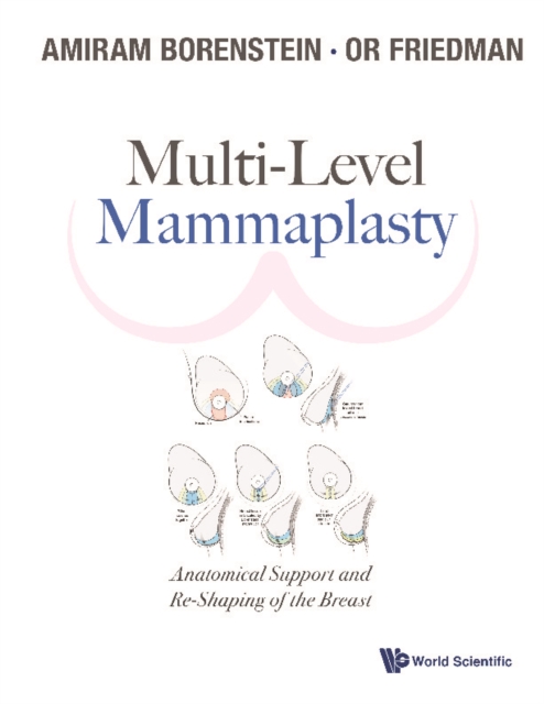 Multi-level Mammaplasty: Anatomical Support And Re-shaping Of The Breast, EPUB eBook