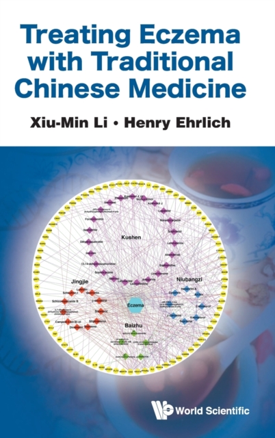 Treating Eczema With Traditional Chinese Medicine, Hardback Book
