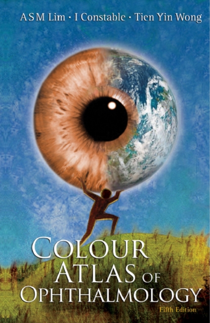 Colour Atlas Of Ophthalmology (5th Edition), PDF eBook